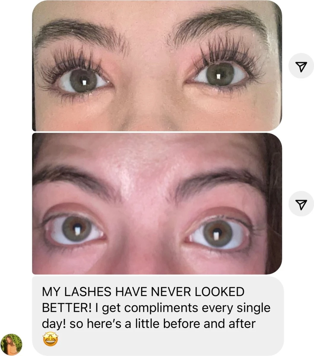 NATURA LASHES - WIMPERSERUM - LASH SERUM - EYELASH GROWTH SERUM - ECHTE RESULTATEN - TOT 55% LANGER EN 75% VOLUMINEUZER OGENDE WIMPERS 5 NATURA LASHES - WIMPERSERUM - LASH SERUM - EYELASH GROWTH SERUM - ECHTE RESULTATEN - TOT 55% LANGER EN 75% VOLUMINEUZER OGENDE WIMPERS - Image 3