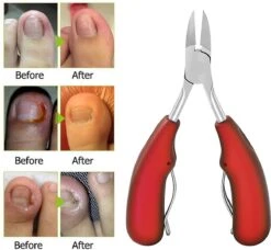 IGOODS Nagelriem Knipper - Professionele Teennagelknipper Cutter Tang - RVS - Zwart - Dikke Nagels Tool Gesneden Nagel - Teen Trimmer -Modecosmetica Winkel 1200x1106 7