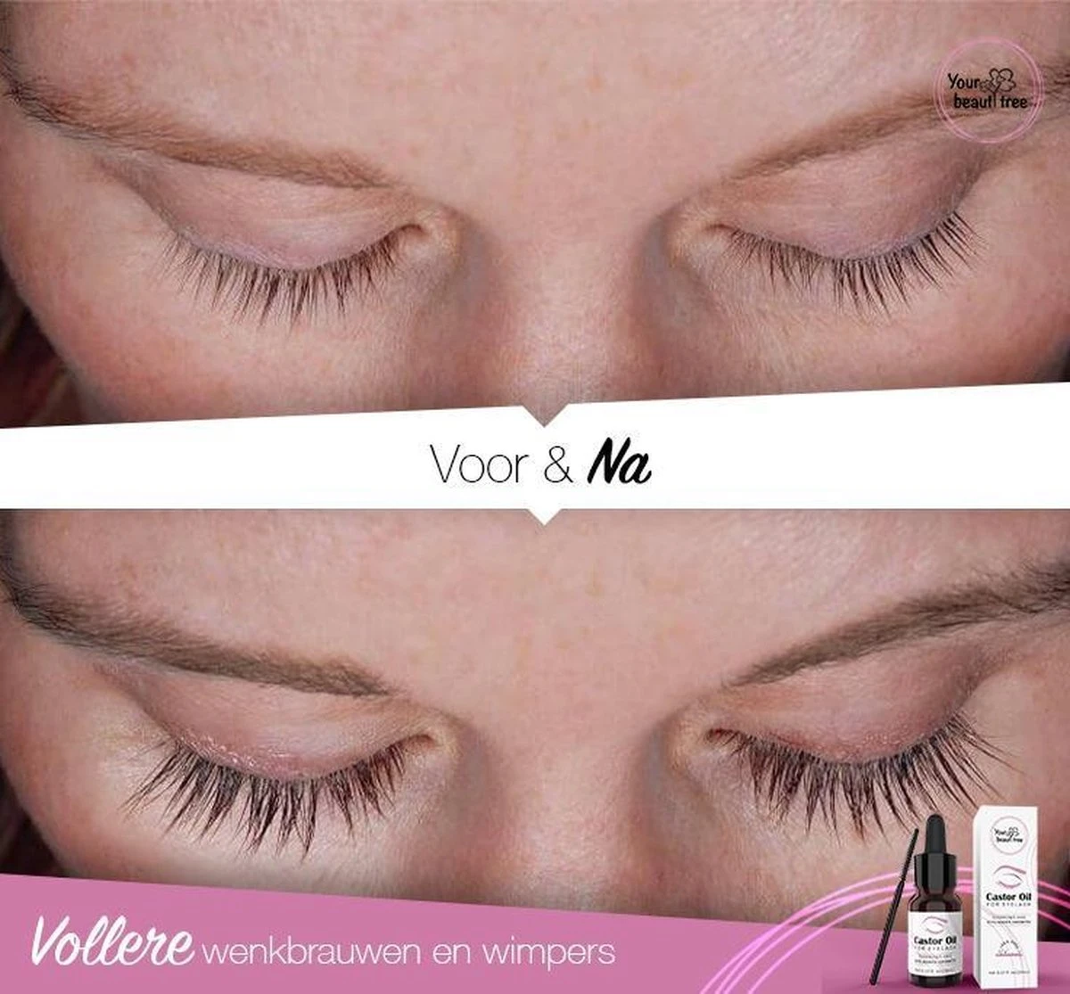 Your Beauty Tree ® Wimper Serum Met Echte Castor Olie |100% Natuurlijke Wimpergroei| Castor Oil Eyelash Serum|Wonder Olie | Wimper Groei | Wenkbrauw Serum | Lash Serum | Wimper Groeimiddel 6 Your Beauty Tree ® Wimper Serum Met Echte Castor Olie |100% Natuurlijke Wimpergroei| Castor Oil Eyelash Serum|Wonder Olie | Wimper Groei | Wenkbrauw Serum | Lash Serum | Wimper Groeimiddel - Image 4