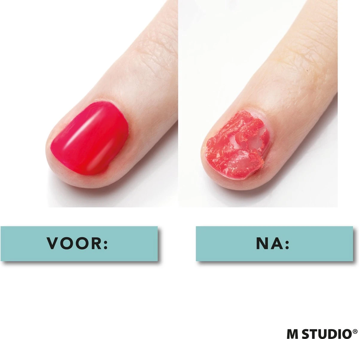 Rosalind Gellak Remover - 15ml - Met Nagelvijl En Bokkenpootje 6 Rosalind Gellak Remover - 15ml - Met Nagelvijl En Bokkenpootje - Image 4