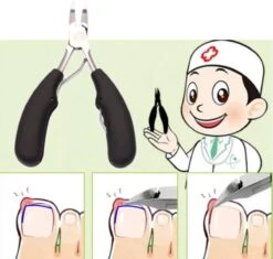 Professionele Nagelschaar Voor Ingegroeide Teennagels- Manicure - Pedicure - Voetverzorging 10 Professionele Nagelschaar Voor Ingegroeide Teennagels- Manicure - Pedicure - Voetverzorging -Modecosmetica Winkel 1200x1140 6