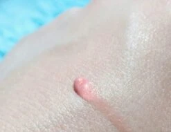 Biodermal Sun Lipbalm SPF25 - Tube 12 Ml - Natural Pink - Lippenbalsem 9 Biodermal Sun Lipbalm SPF25 - Tube 12 Ml - Natural Pink - Lippenbalsem -Modecosmetica Winkel 1200x927 4