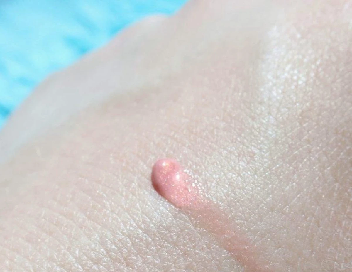 Biodermal Sun Lipbalm SPF25 - Tube 12 Ml - Natural Pink - Lippenbalsem 6 Biodermal Sun Lipbalm SPF25 - Tube 12 Ml - Natural Pink - Lippenbalsem - Image 4